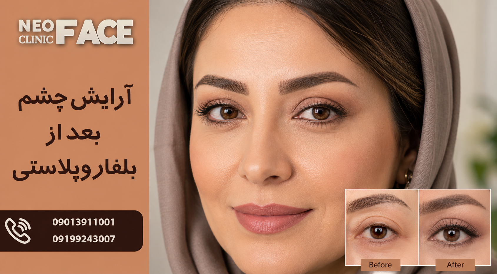 آرایش چشم بعد از بلفاروپلاستی