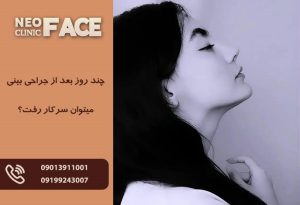 رفتن به سر کار بعد از جراحی بینی