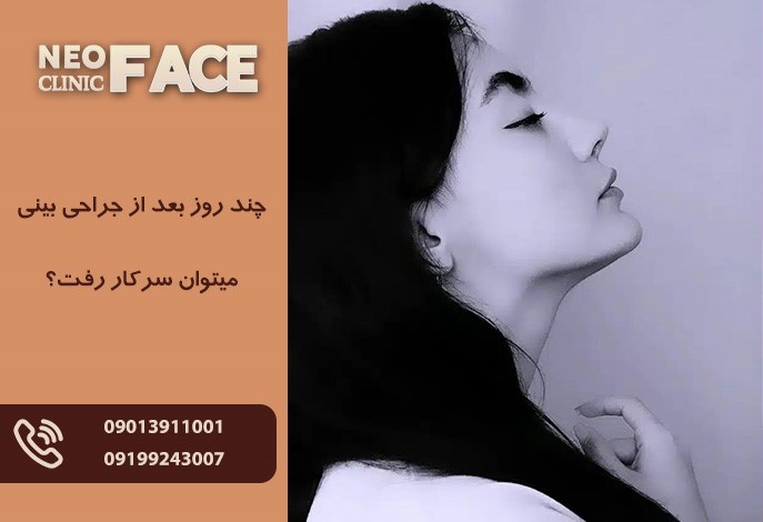 رفتن به سر کار بعد از جراحی بینی